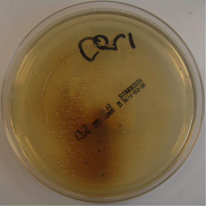 Colour of the Urine and Water Infection