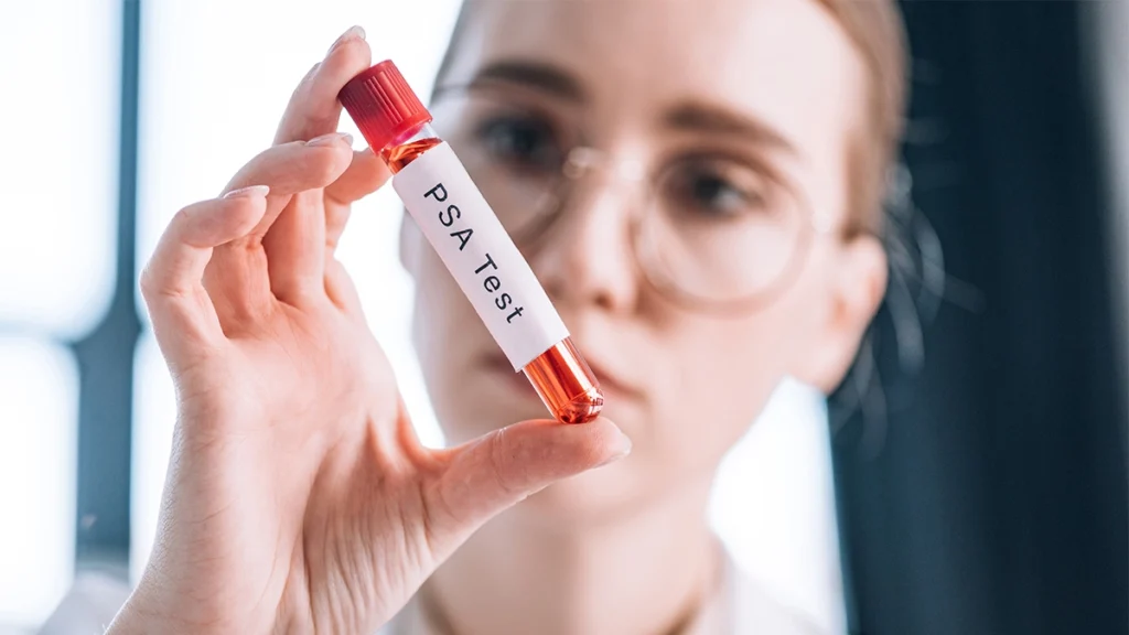Medical professional holding a test tube with PSA test written on it