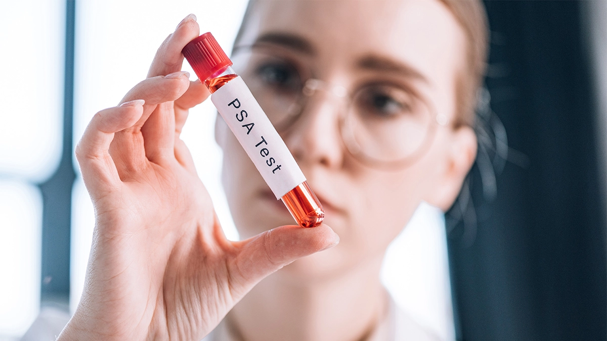 PSA Test Explained: Purpose, Results & What They Mean